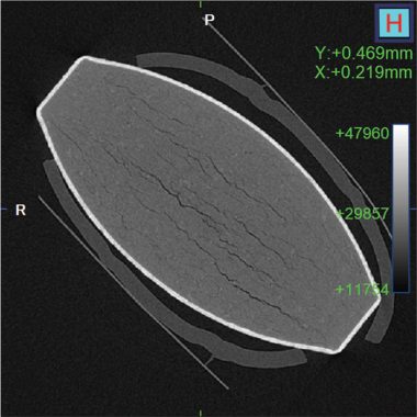 tablet ct scan side view